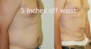 before and after plastic surgery photos
